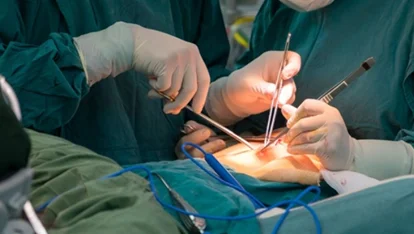 	INSTRUMENTAL DELIVERY (FORECEPS AND VENTOUSE) 