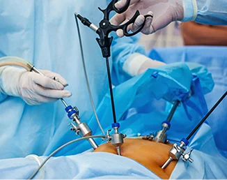 Gynecological Laparoscopic