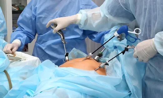 Total Laparoscopic Hysterectomy