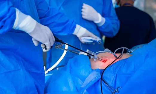 Laparoscopic Tuboplasty