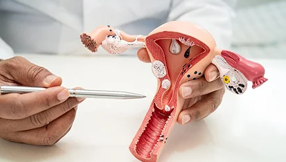 Hysteroscopic Polypectomy