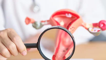 Advice on PCOS, Endometriosis, Abnormal Uterine Bleeding