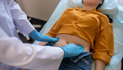 Abdominal Myomectomy